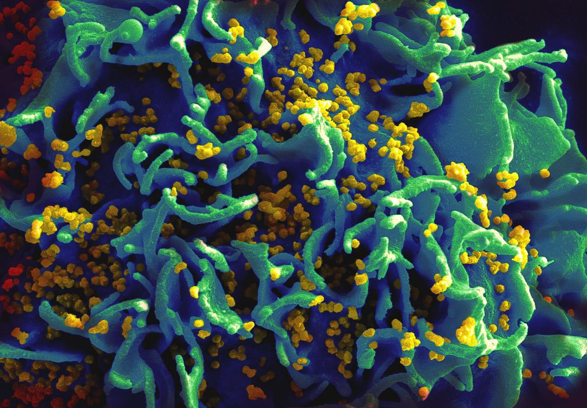 Thử nghiệm thuốc diệt vi khuẩn trực tràng của NIH để phòng ngừa HIV bắt đầu tại Hoa Kỳ
