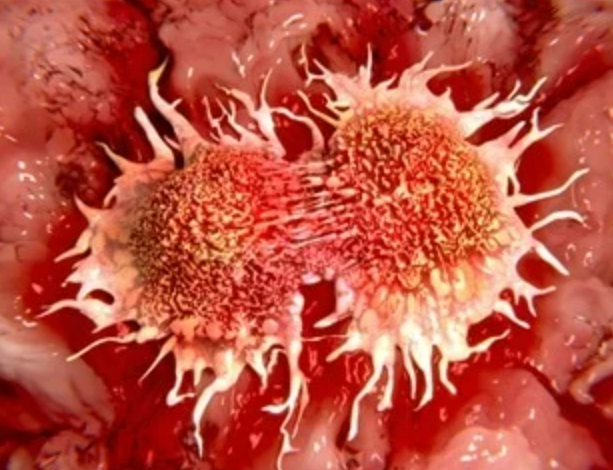 Các nhà khoa học phát triển tế bào lympho T trẻ hóa mạnh mẽ có nguồn gốc từ iPSC để điều trị ung thư cổ tử cung