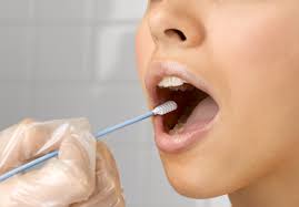 Xét nghiệm nước bọt mang lại nhiều hy vọng cho bệnh nhân ung thư đầu cổ