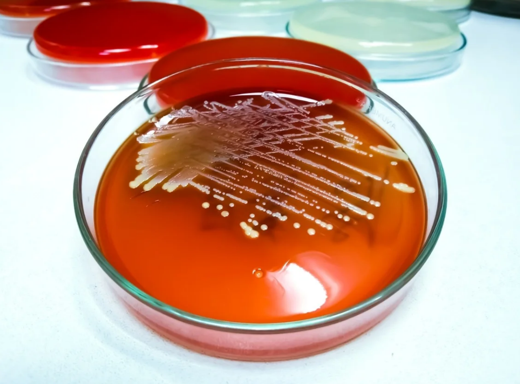 Liệu pháp kích hoạt bằng ánh sáng làm giảm khả năng kháng kháng sinh ở Staphylococcus aureus